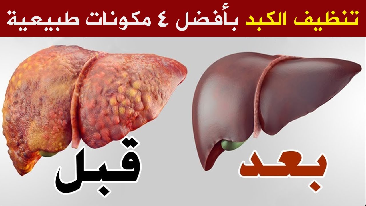 اقوى مشروب صباحى لتنظيف سموم الكلي والكبد وتنظيف سموم الجسم