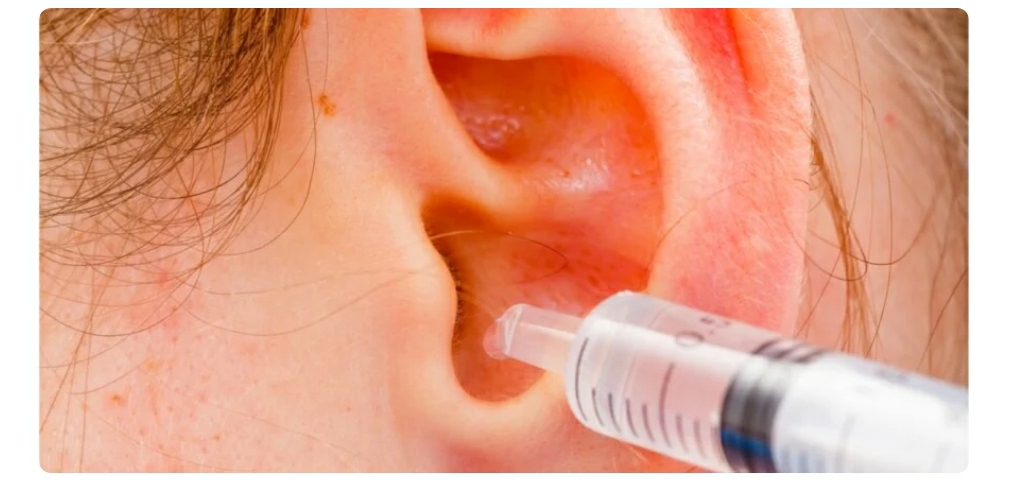 انسى الألم وتراكم الشمع! طريقة منزلية آمنة لتنظيف الأذن في دقائق