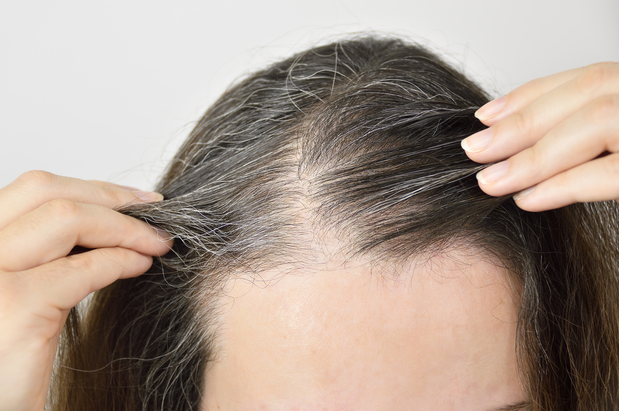 الخلطة المعجزة لصبغ الشعر الأبيض من الجذور والتخلص من الشيب في يومين فقط.. حل فعال بنسبة 100%